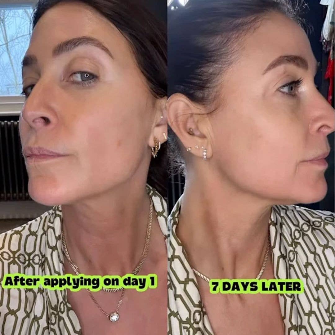 Lisa Snowdon, 54, hails this neck serum for tightening saggy skin